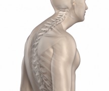 Man spine kyphosis phase 3 isolated