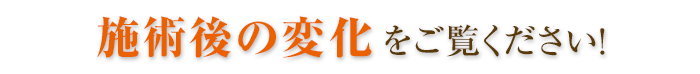 施術後の変化をご覧ください